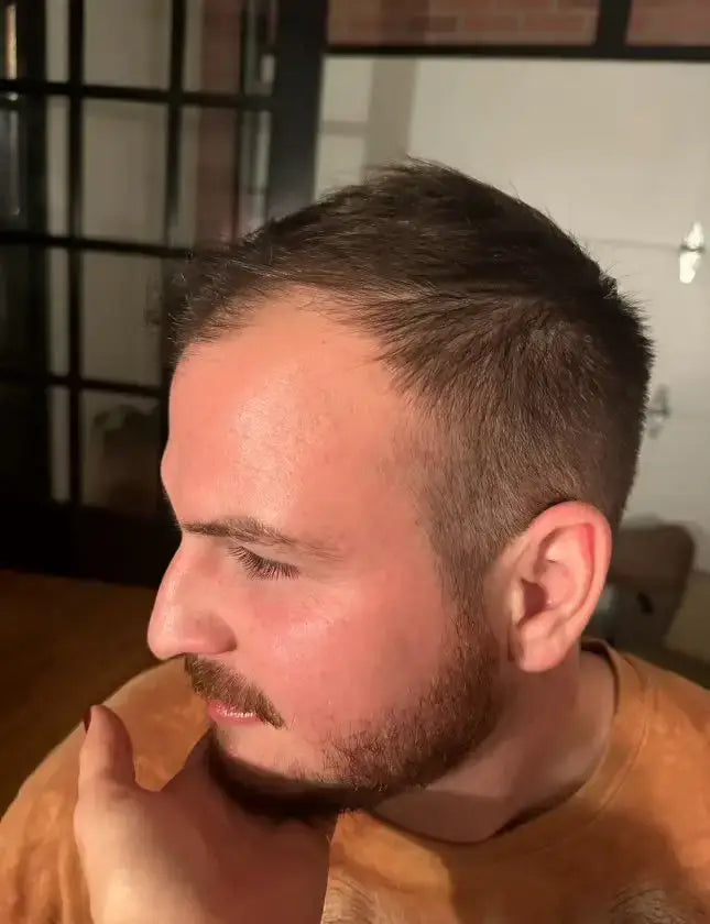 before using hairapy hair thickening products