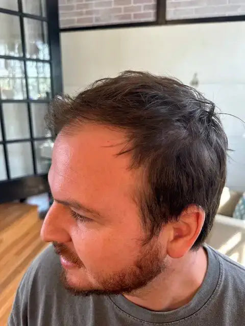 before using hairapy hair thickening products