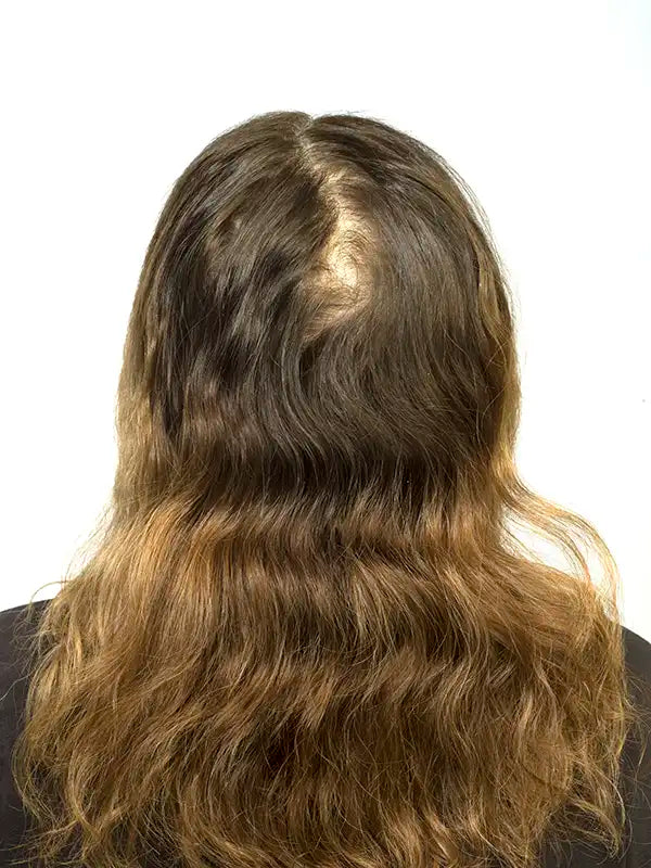 hairapy hair growth before and after