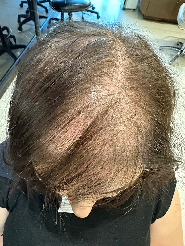 hair thickening before and after