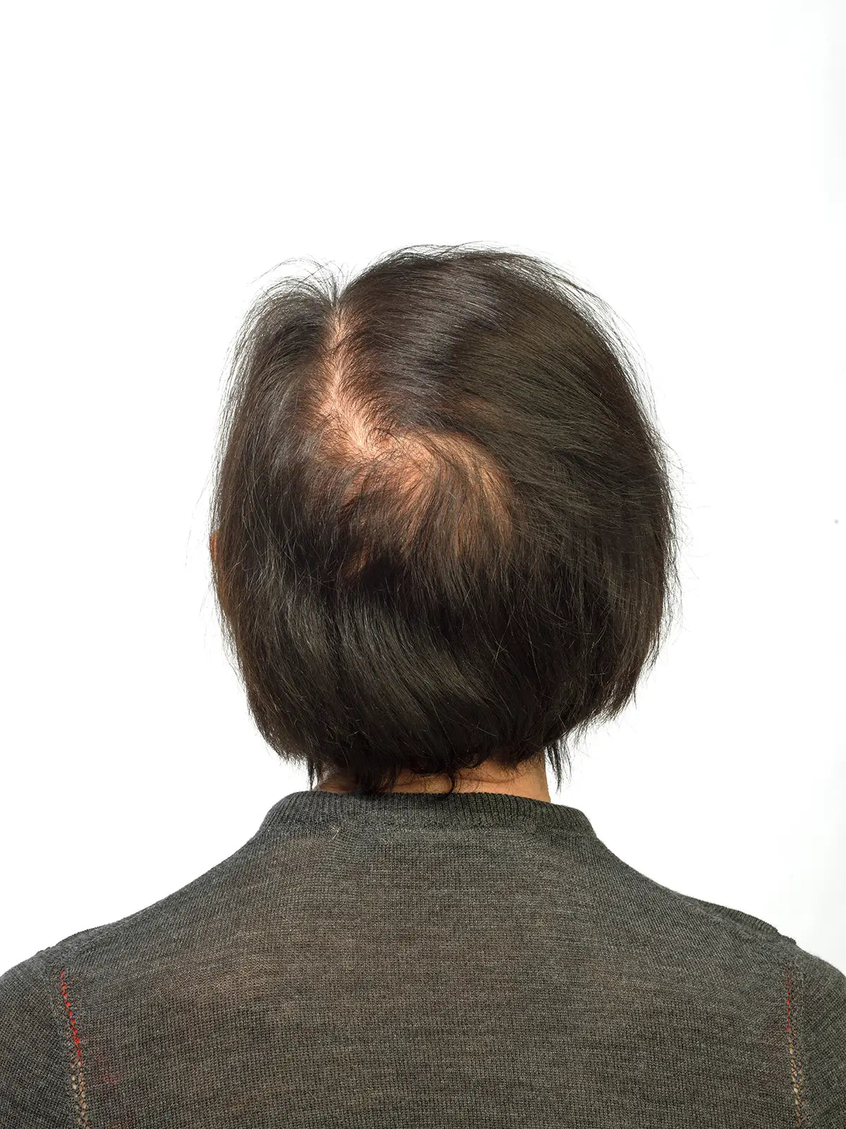 hair growth products before & after